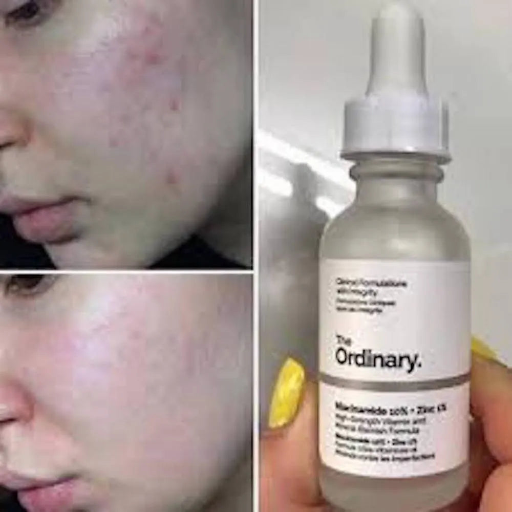 Niacinamida the ordinary